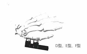 HM-10900掌骨、指骨系列